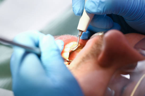 Best Root Canal Emergency Dentist  in Middle River, MD